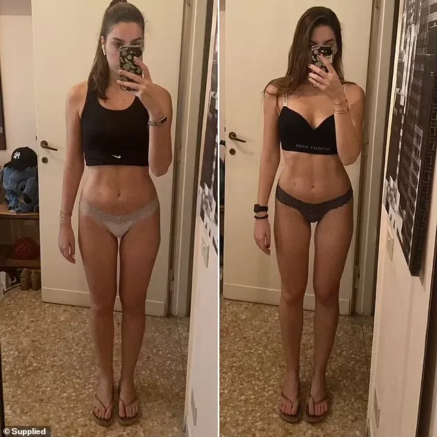 Before‑and‑after leg symmetry comparison.